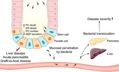 Multifaceted involvements of Paneth cells in various diseases within intestine and systemically